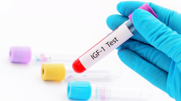 Insulin-Like Growth Factor 1 (IGF-1):